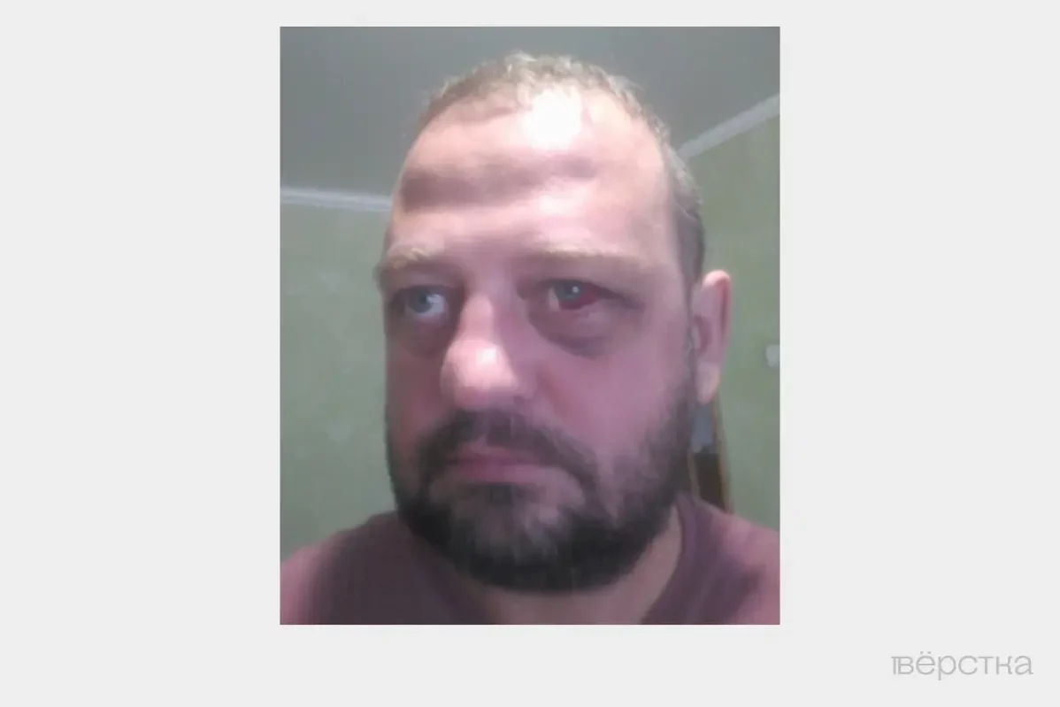 Селфи Валентина Харламова после побоев в&nbsp;полиции