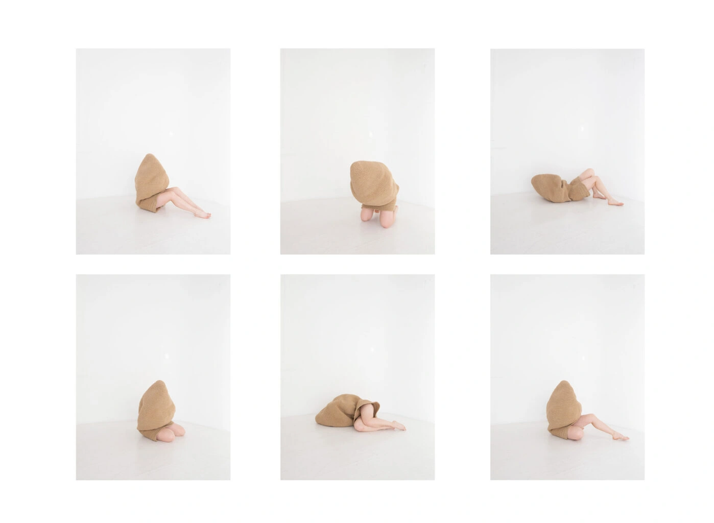 Прием оральных контрацептивов (КОК)&nbsp;— один из&nbsp;самых распространенных медикаментозных методов снижения симптомов и&nbsp;регуляции состояния при синдроме поликистоза яичников